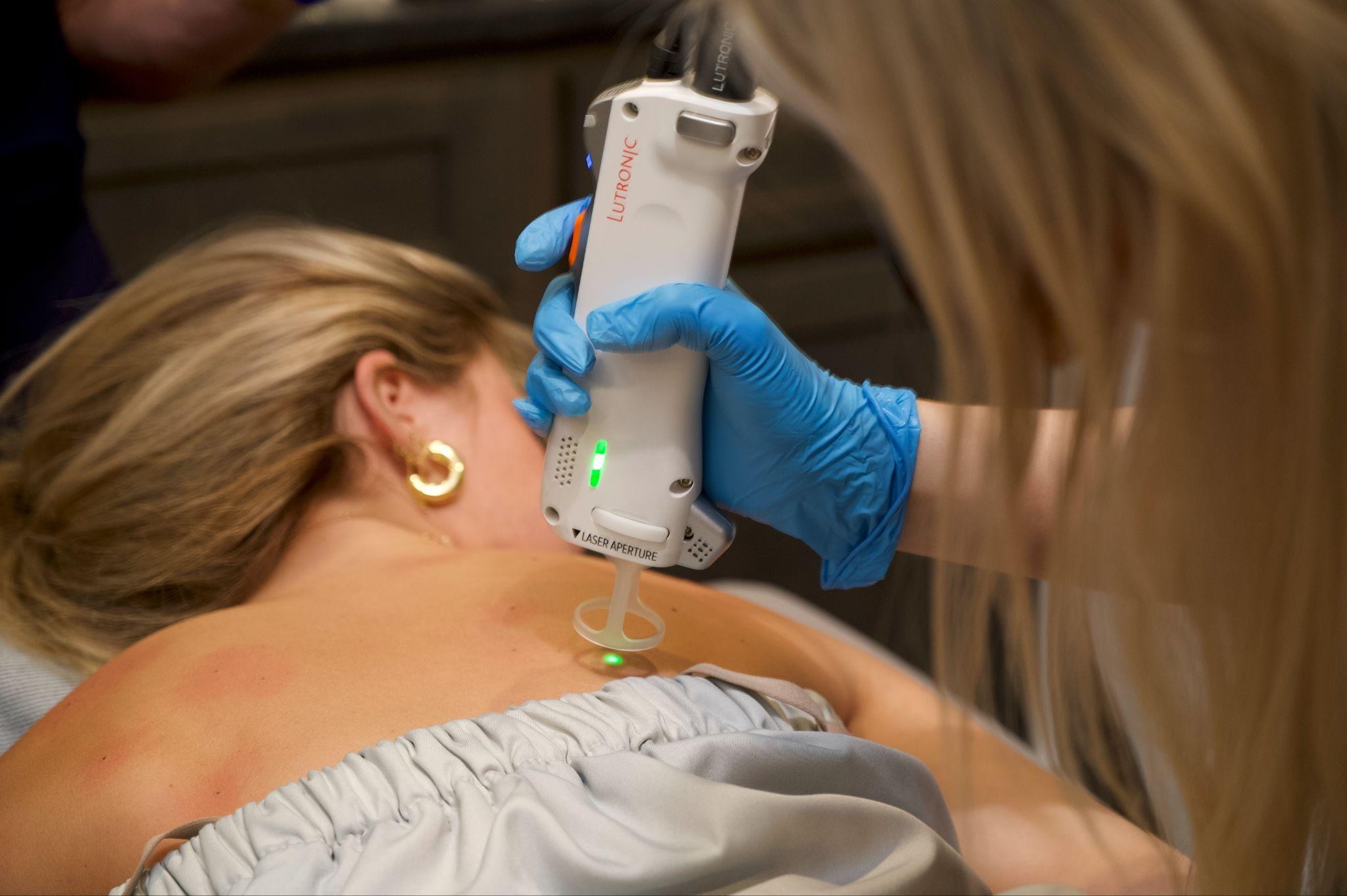 What is the advantages of Lutronic Clarity II for laser hair removal in Knoxville, TN?