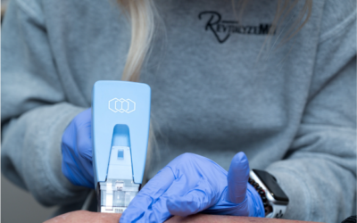 The Ultimate Guide to Morpheus8 Body: Transform Your Skin With RF Microneedling in Knoxville, TN