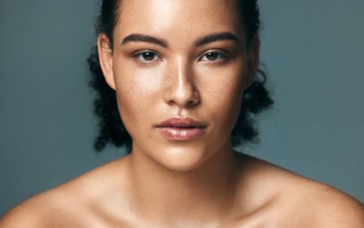 How to Fade Melasma Fast: Best Treatments for Dark Spots & Discoloration