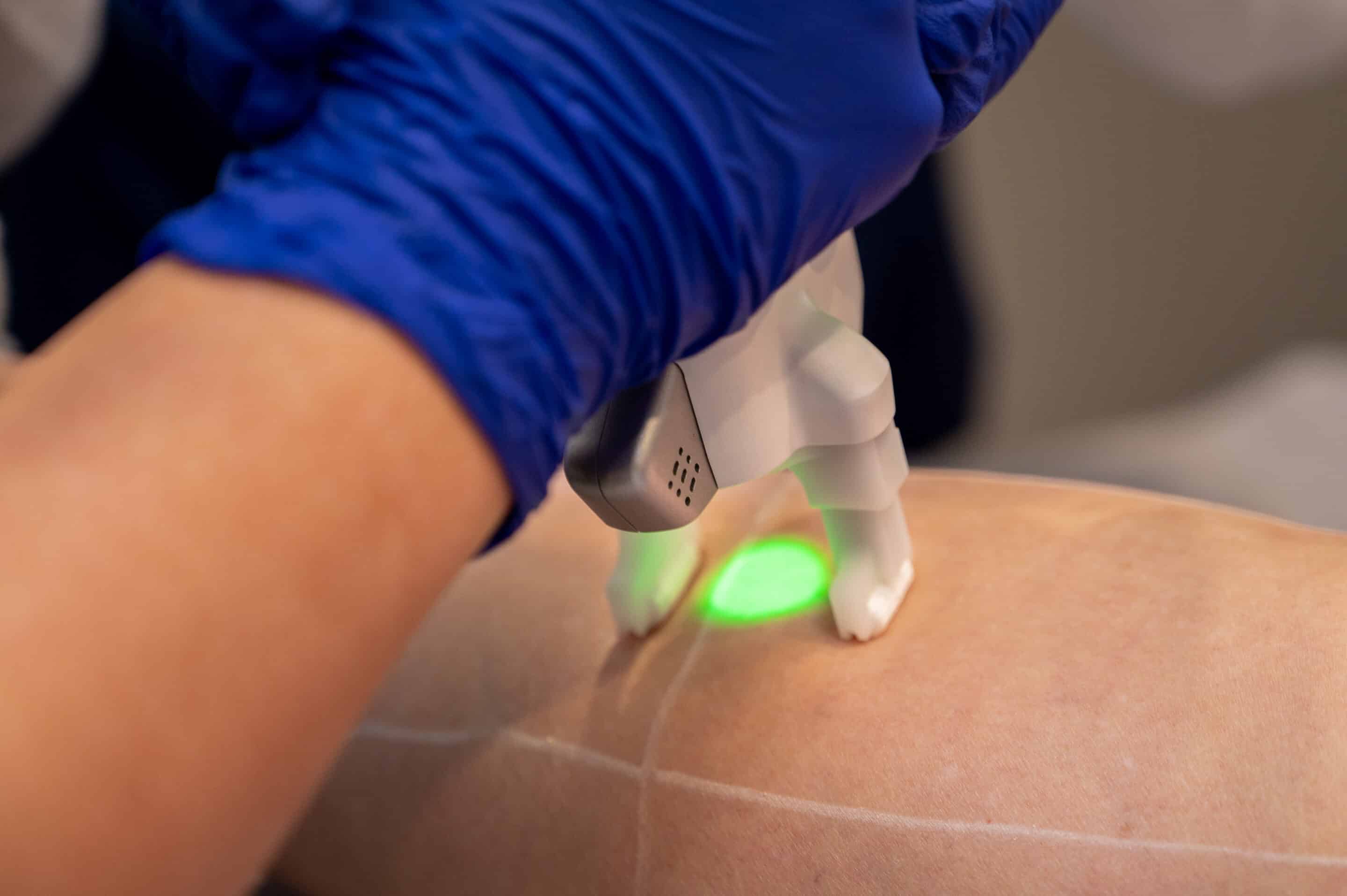 Patient receiving botox injection